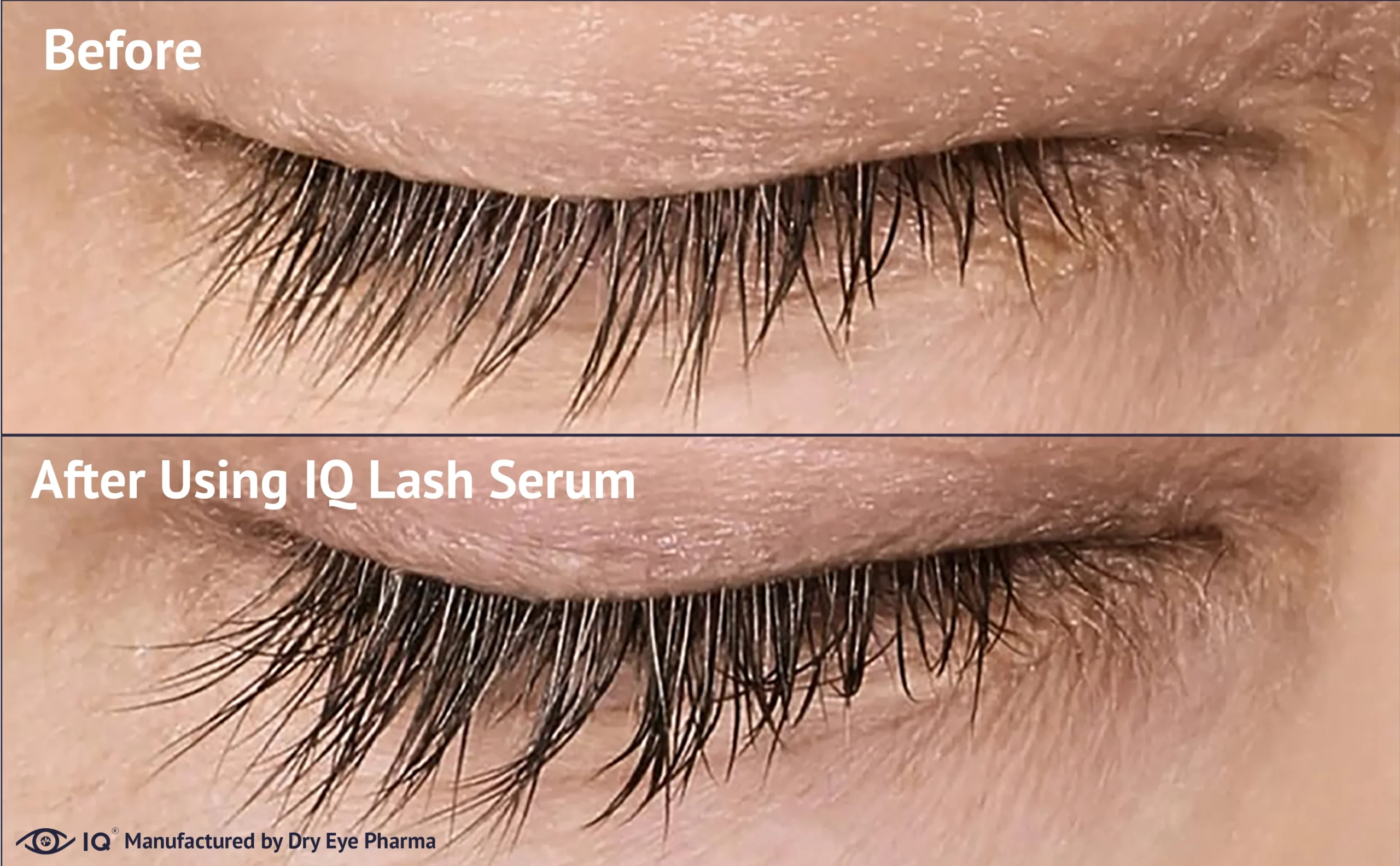 iq-eyelash-serum (3)